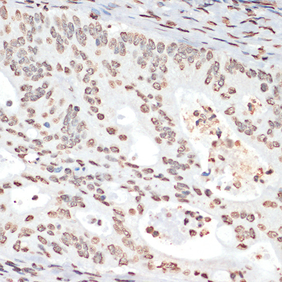 Anti-Phospho-MAPKAP Kinase 2 (Thr334) Rabbit pAb