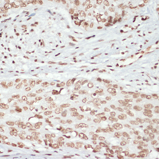 Anti-Phospho-MAPKAP Kinase 2 (Thr334) Rabbit pAb