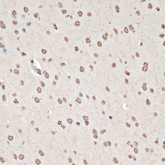 Anti-Phospho-MAPKAP Kinase 2 (Thr334) Rabbit pAb