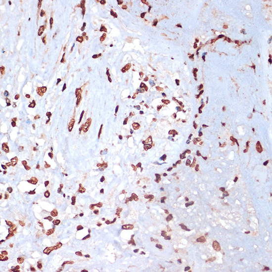 Anti-Phospho-MAPKAP Kinase 2 (Thr334) Rabbit pAb