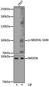 Anti-Phospho-NEDD4L (Ser448) Rabbit pAb