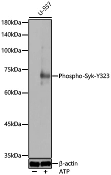 Anti-Phospho-Syk (Tyr323) Rabbit pAb