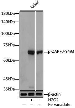 Anti-Phospho-ZAP70 (Tyr493) Rabbit pAb