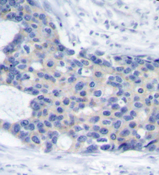 Anti-Phospho-ZAP70 (Tyr493) Rabbit pAb