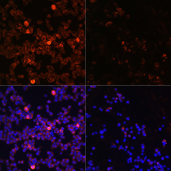 Anti-Phospho-ZAP70 (Tyr493) Rabbit pAb