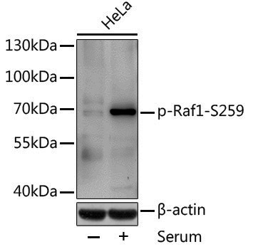 Anti-Phospho-Raf1 (Ser259) Rabbit pAb
