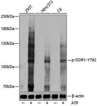 Anti-Phospho-DDR1 (Tyr792) Rabbit pAb