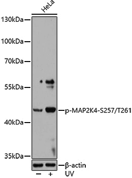 Anti-Phospho-MEK4 (Ser257/Thr261) Rabbit pAb