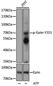 Anti-Phospho-Ezrin (Tyr353) Rabbit pAb