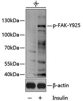 Anti-Phospho-FAK (Tyr925) Rabbit pAb