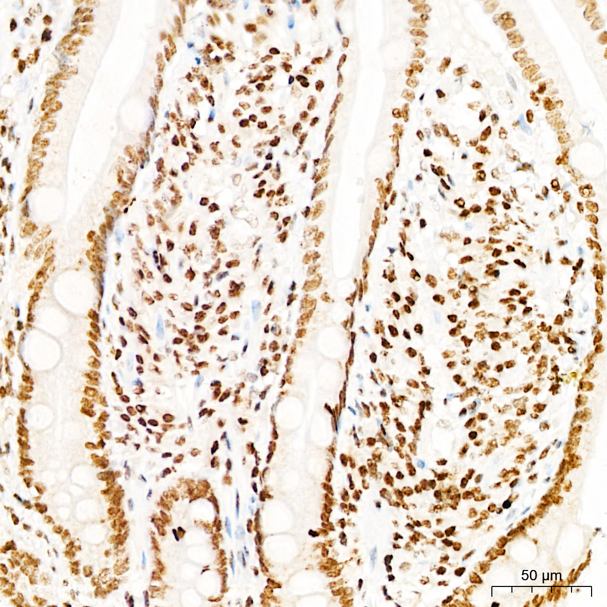Anti-Phospho-DNA PKcs (Ser2056) Rabbit pAb