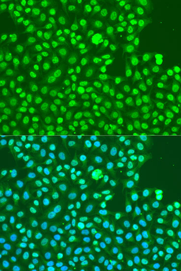Anti-Phospho-DNA PKcs (Ser2056) Rabbit pAb
