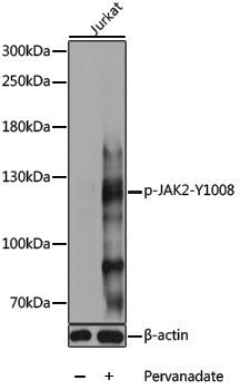 Anti-Phospho-JAK2 (Tyr1008) Rabbit pAb