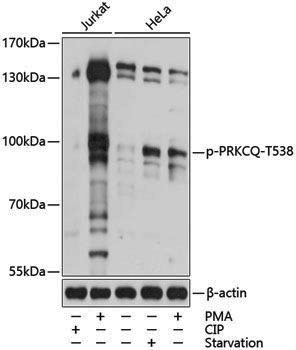 Anti-Phospho-PKC theta (Thr538) Rabbit pAb