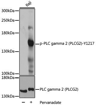 Anti-Phospho-PLCG2 (Tyr1217) Rabbit pAb