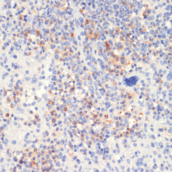 Anti-Phospho-PLCG2 (Tyr1217) Rabbit pAb