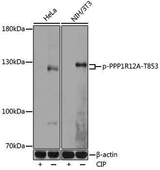 Anti-Phospho-MYPT1 (Thr853) Rabbit pAb