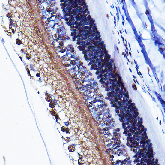 Anti-Phospho-Cyclin D1 (Thr286) Rabbit pAb