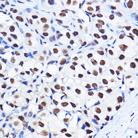 Anti-Phospho-Cyclin D1 (Thr286) Rabbit pAb