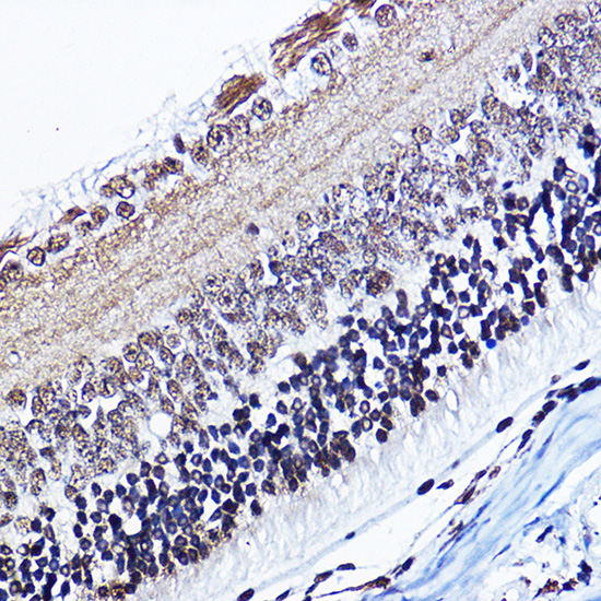 Anti-Phospho-Cyclin D1 (Thr286) Rabbit pAb