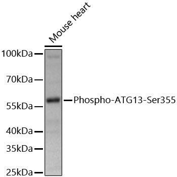 Anti-Phospho-ATG13 (Ser355) Rabbit pAb