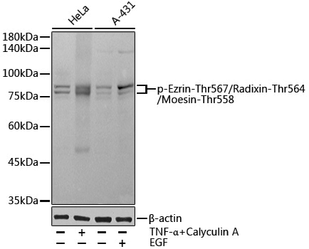 Anti-Phospho-Ezrin (Thr567)/Radixin (Thr564)/Moesin (Thr558) Rabbit pAb