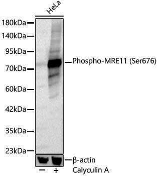 Anti-Phospho-MRE11 (Ser676) Rabbit pAb