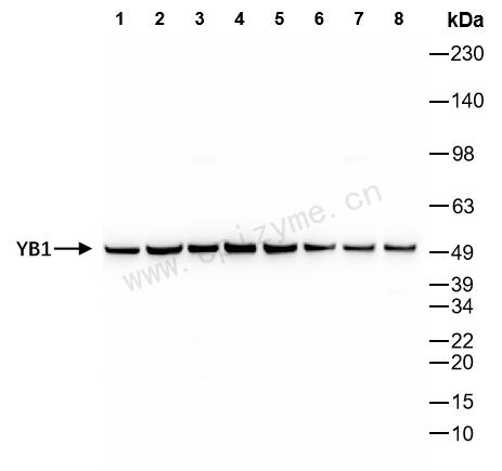 Anti-YB1 Rabbit mAb [91L21K01]