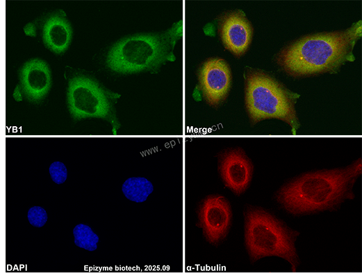 Anti-YB1 Rabbit mAb [91L21K01]
