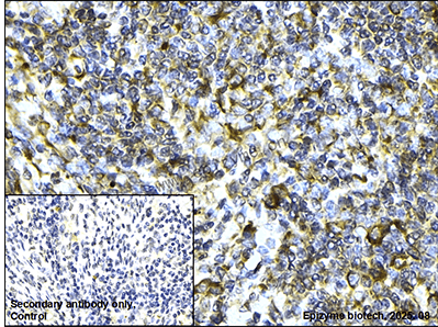 Anti-YB1 Rabbit mAb [91L21K01]