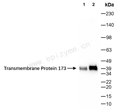 Anti-TMEM173 Rabbit mAb [62K99K52]