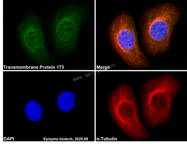 Anti-TMEM173 Rabbit mAb [62K99K52]