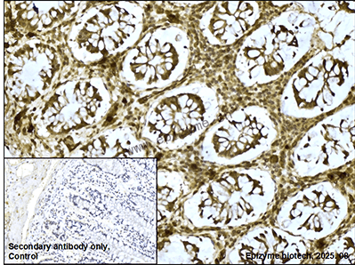 Anti-TMEM173 Rabbit mAb [62K99K52]