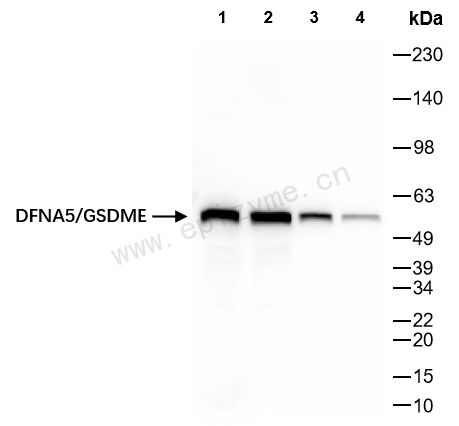 Anti-GSDME Rabbit mAb [92K35M15]