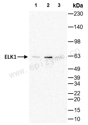 Anti-ELK1 Rabbit mAb [26M38M98]