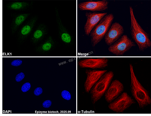 Anti-ELK1 Rabbit mAb [26M38M98]