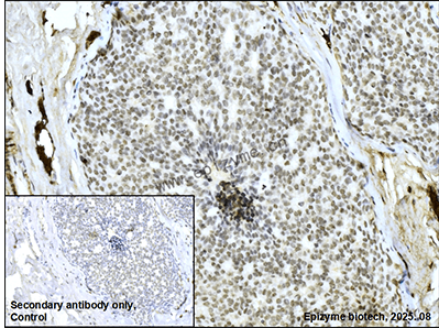 Anti-ELK1 Rabbit mAb [26M38M98]