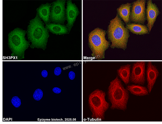 Anti-SNX9 Rabbit mAb [28M81L20]