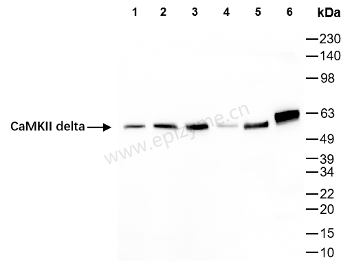 Anti-CaMKII delta Rabbit mAb [93K60L89]