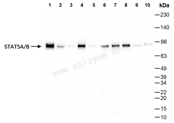 Anti-STAT5a/STAT5b Rabbit mAb [69M23K46]