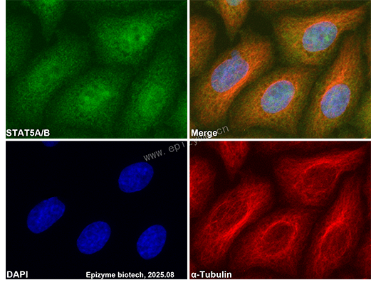 Anti-STAT5a/STAT5b Rabbit mAb [69M23K46]