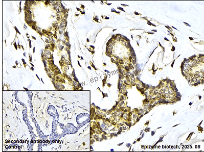 Anti-STAT5a/STAT5b Rabbit mAb [69M23K46]
