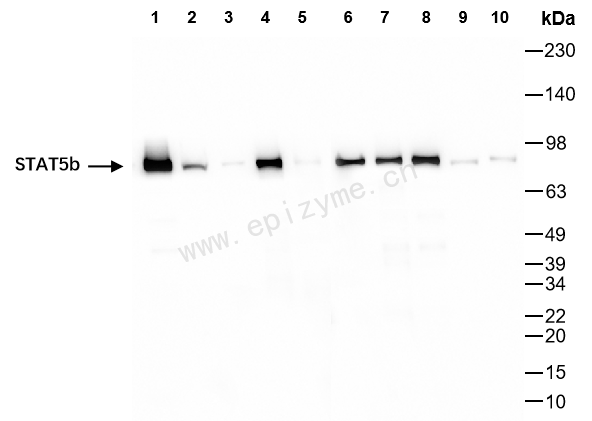 Anti-STAT5b Rabbit mAb [19M98L01]