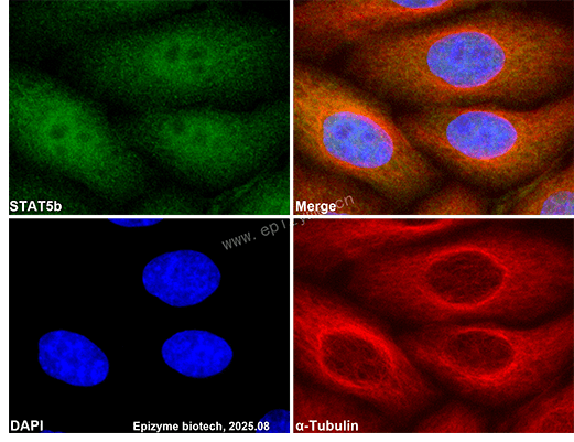 Anti-STAT5b Rabbit mAb [19M98L01]