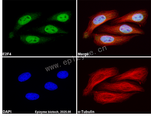 Anti-E2F4 Rabbit mAb [84M24L36]