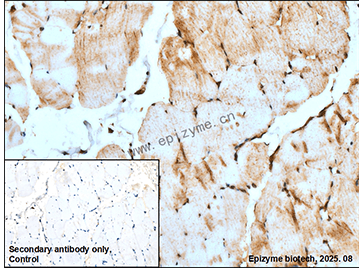 Anti-Cellular Apoptosis Susceptibility Rabbit mAb [70K70K72]