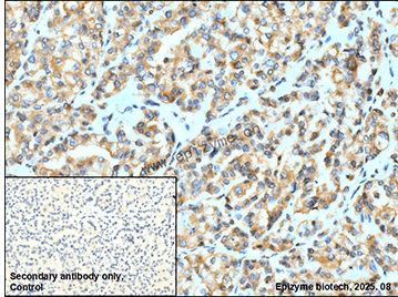 Anti-Cellular Apoptosis Susceptibility Rabbit mAb [70K70K72]