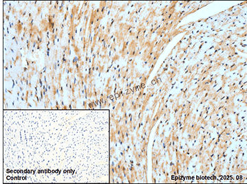 Anti-Cellular Apoptosis Susceptibility Rabbit mAb [70K70K72]