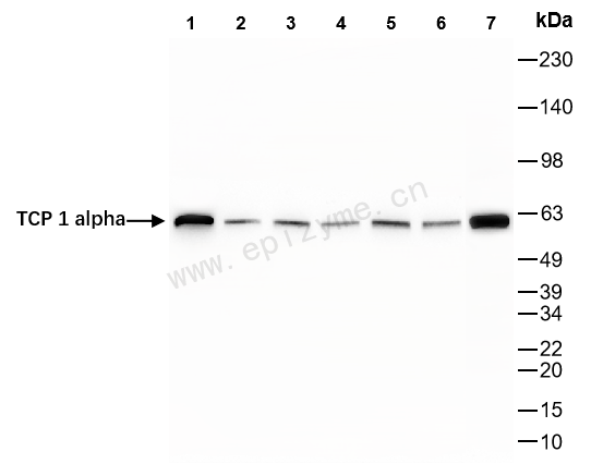 Anti-TCP 1 alpha Rabbit mAb [61L42K79]