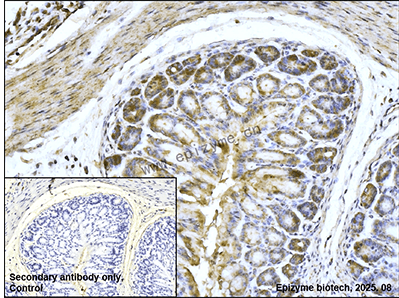 Anti-TCP 1 alpha Rabbit mAb [61L42K79]